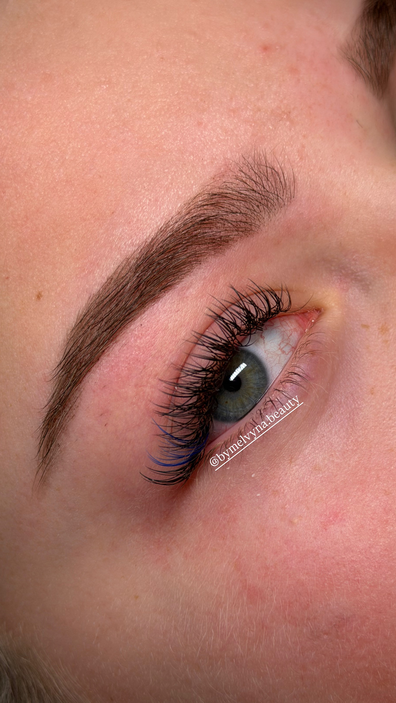 Cils