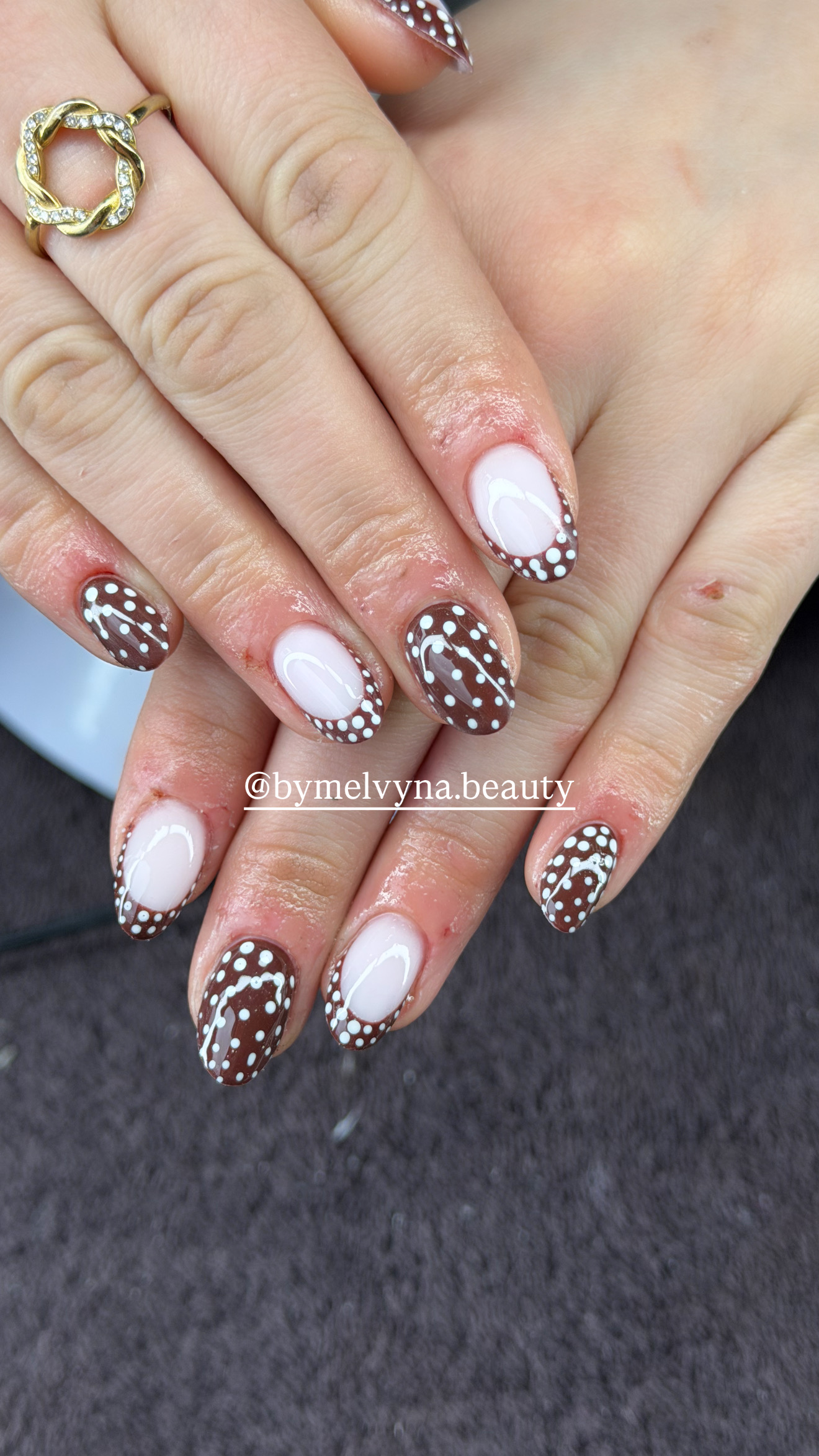 Ongles